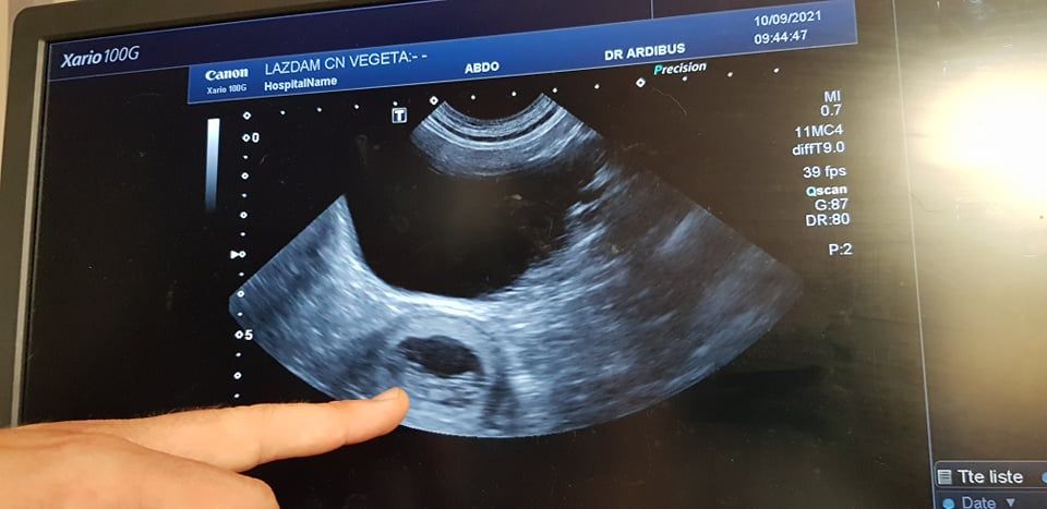 du Val de Méouge - Bébés fauves attendus à la mi octobre 2021